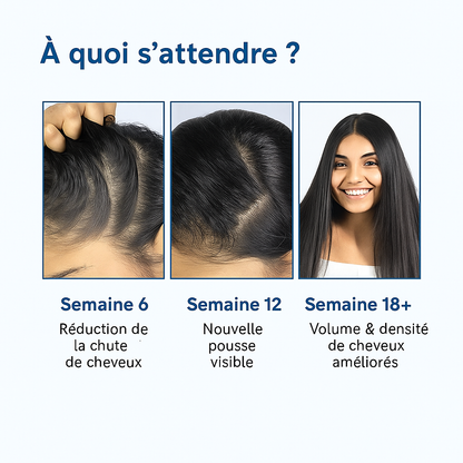 Arrêtez la chute de cheveux naturellement